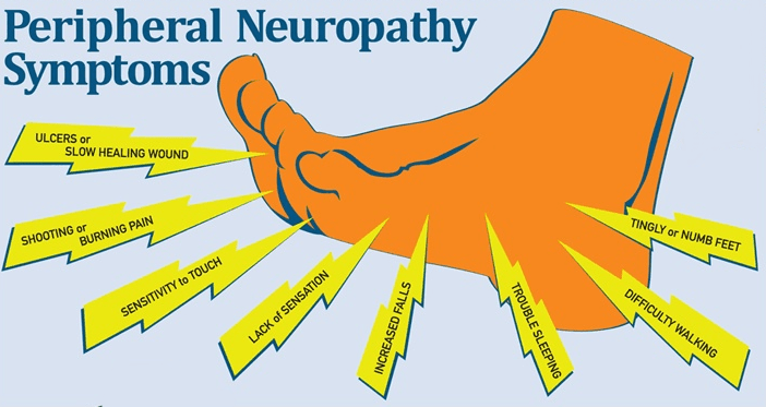 Diabetic Peripheral Neuropathy