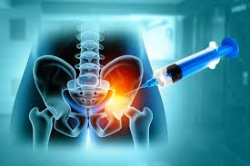 Sacroiliac Joint Injection