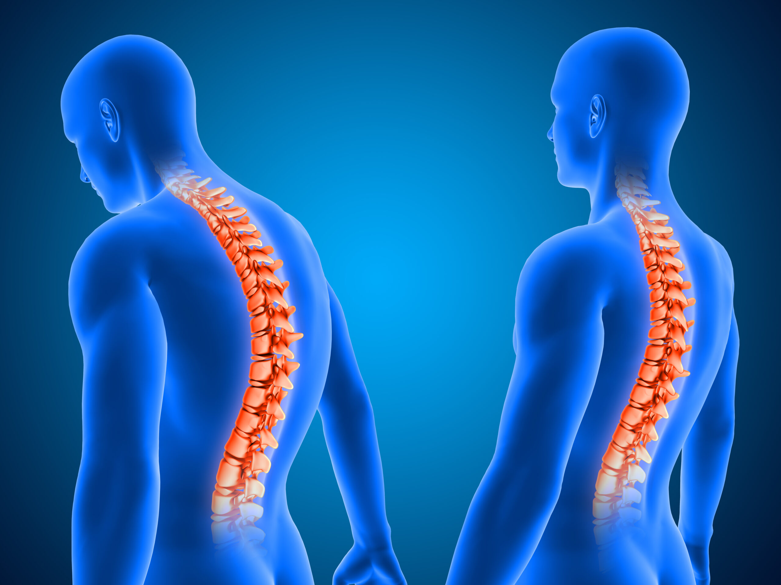 Correct and Poor Posture Spine Highlighted 3D Render